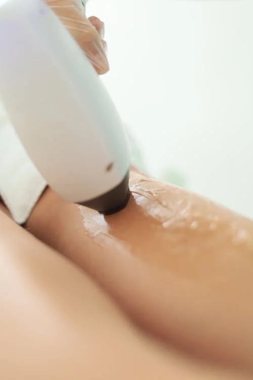the process of hair removal