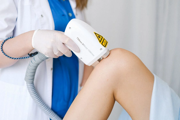 a laser treatment