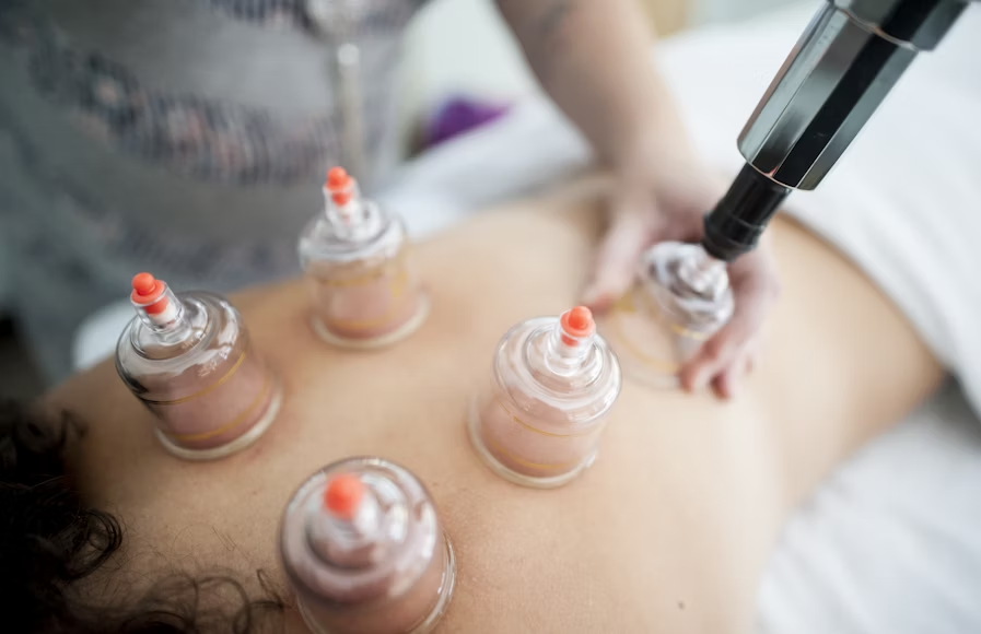 a person receiving cupping therapy 