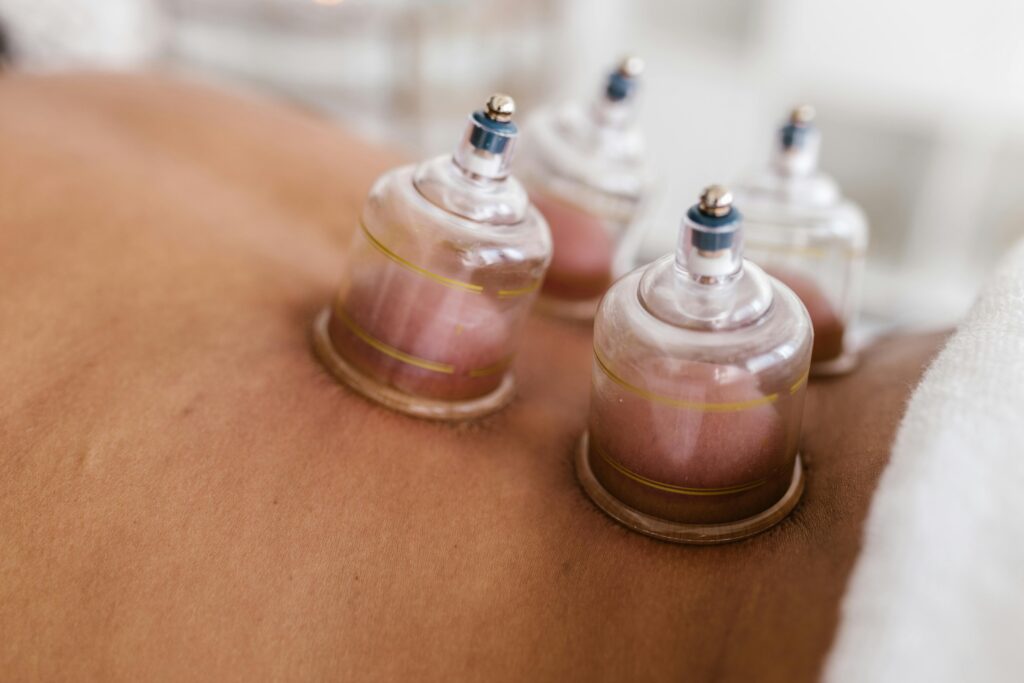 man getting cupping therapy