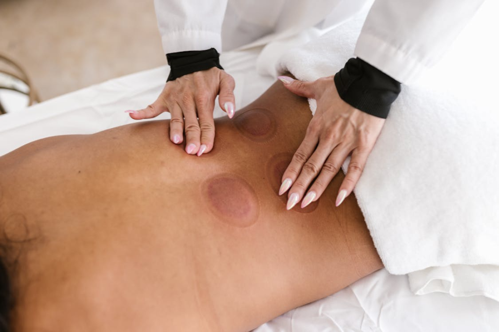 close-up of a masseur touching marks on the back of a client after cupping therapy